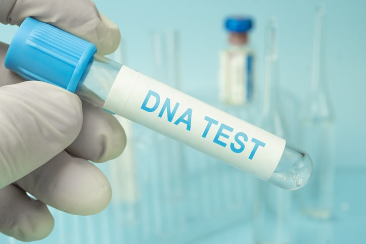 https://www.oe-legaldefense.com/cell-phone-tracking-and-criminal-cases-can-location-data-be-trusted/
https://www.oe-legaldefense.com/how-advancements-in-dna-testing-could-impact-your-criminal-case/
https://www.oe-legaldefense.com/how-internet-crimes-are-prosecuted-in-new-york-defending-against-online-solicitation-charges/
DNA Testing in Criminal Defense